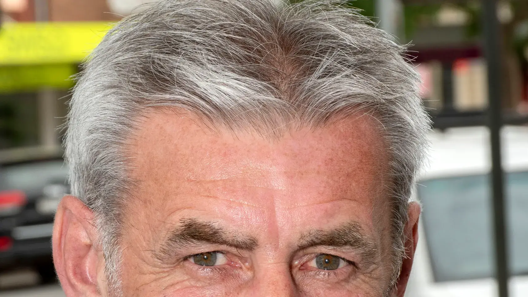 Concerns about lack of shade at sports facilities