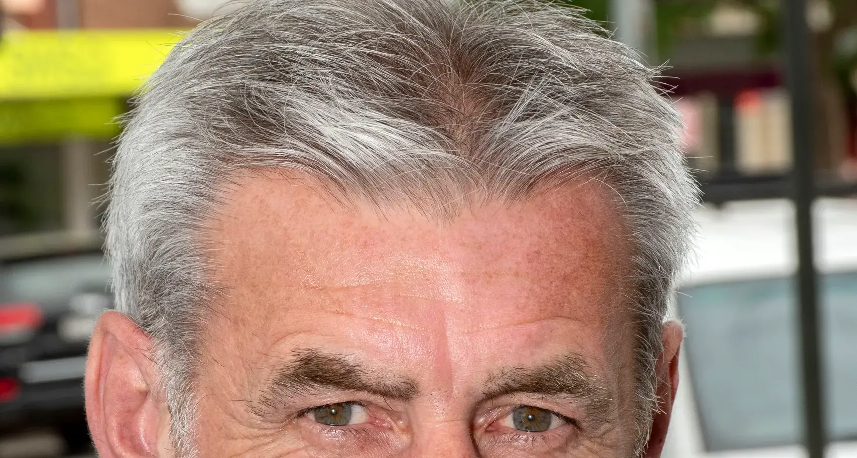 Concerns about lack of shade at sports facilities