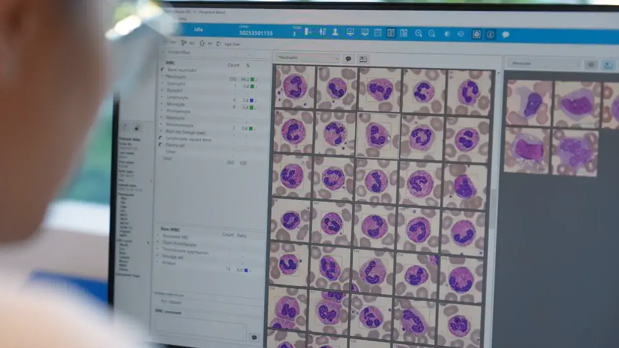 $2.8m to speed up pathology results in region