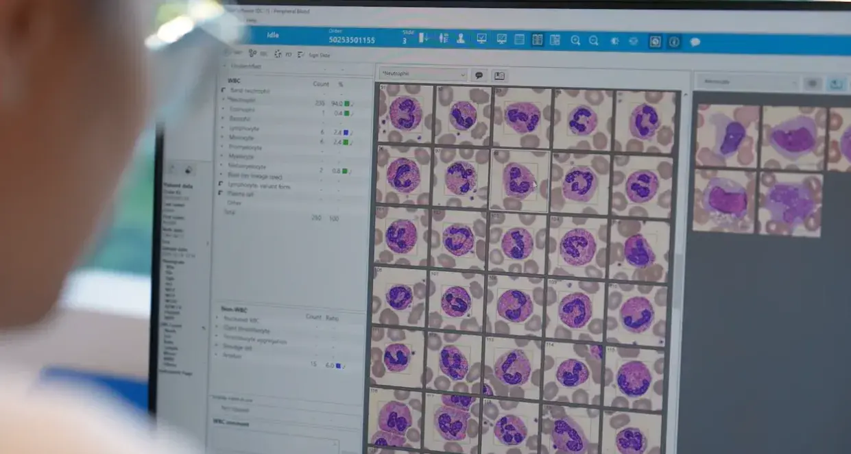 $2.8m to speed up pathology results in region