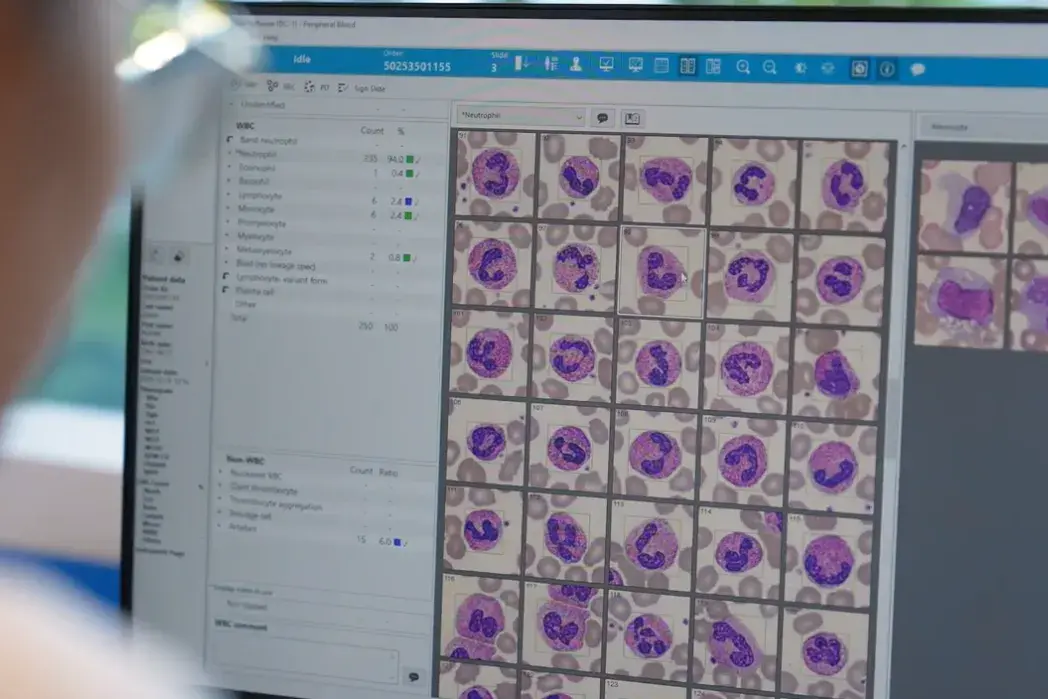 <p>FAST TESTING: Point of care testing technology provides pathology results within minutes, enabling doctors to diagnose patients faster and make critical treatment decisions without the need to send samples to a laboratory. </p>\\n