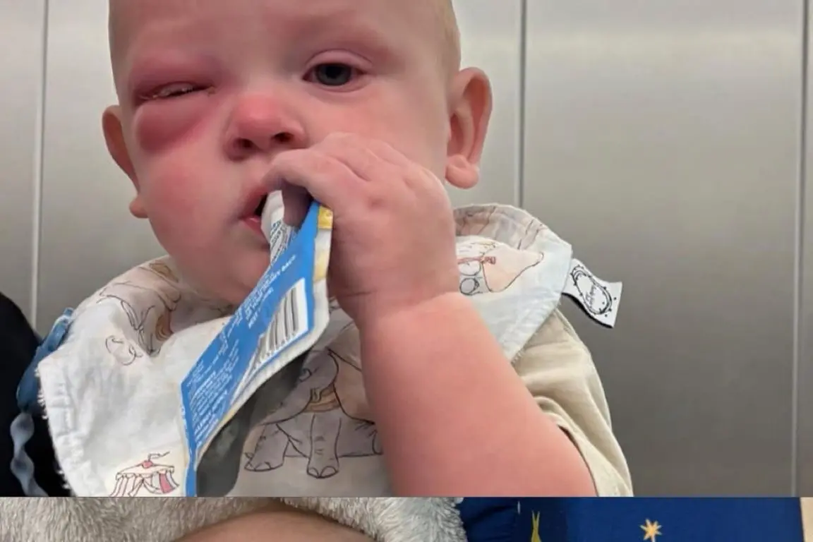 <p>Narrandera baby Carter who has been diagnosed with Periorbital Cellutis.</p>\\n